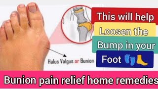 Bunion pain relief home remedies [upl. by Timothea]