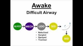 Airway Sequences 04 Awake Intubation [upl. by Aubreir711]