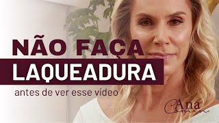 Não faça LAQUEADURA sem ver esse vídeo [upl. by Hecklau]