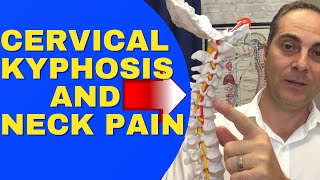 Cervical Kyphosis And Neck Pain REVERSAL CERVICAL LORDOSIS Dr Walter Salubro Chiropractor In Vaughan [upl. by Dimo]