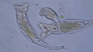 Rotifer Philodina [upl. by Artap]