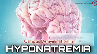 Osmotic Demyelination in HYPONATREMIA  3D animated videos  brain dysfunction [upl. by Sewole]