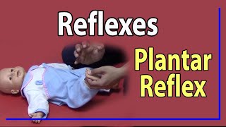 22 Plantar Reflex [upl. by Durward]