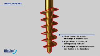 The All New BioLine Single Piece Implant System [upl. by Floeter389]