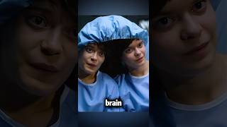 The twins shared a brain for 18 years shorts [upl. by Lodovico]