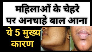 महिलाओं के चेहरे पर बाल क्यों आते हैं । कारण । Hirsutism क्या है  Causes  Prevention In Hindi [upl. by Nanreh]