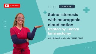 Case study 63 Lumbar degenerative spinal stenosis treated wlumbar laminectomy explained by surgeon [upl. by Orazio579]