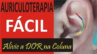 Auriculoterapia Nas Algias Vertebrais Aprenda Grátis Auriculoterapia [upl. by Airdnazxela]