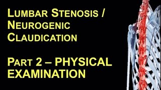 Lumbar Stenosis  Neurogenic Claudication Part 2 – Physical Examination [upl. by Sinned]