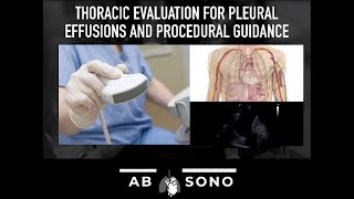 Thoracic evaluation for pleural effusions and procedural guidance [upl. by Arick203]