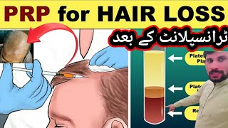 PRP Hair treatment again naya pakistan Khuram Abbas [upl. by Ailaht488]