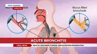 Acute Bronchitis [upl. by Florie]