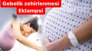 EKLAMPSİ TANI VE TEDAVİSİNDE PÜF NOKTALAR NELERDİR [upl. by Annaeg]