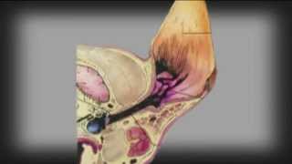 Canine Otitis Externa [upl. by Anniram]