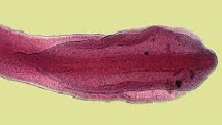 Para GIT  General Characters of Cestoda  Diphyllobothrium latum Fish tape worm  broad tape worm [upl. by Hiamerej]