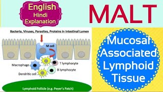 MALT  Mucosal Associated Lymphoid Tissue Secondary lymphoid Organ What is Malt  How does it work [upl. by Charmion]