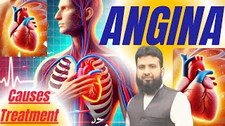 ANGINA treatment in homeopathy•what is ANGINA [upl. by Anaerda]