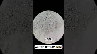 Pimples at 400X magnification are really cool underthemicroscope beefcut scienceshorts [upl. by Friedlander100]