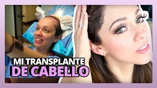 MI TRANSPLANTE DE CABELLO  HAIR TRANSPLANT SURGERY  RosyStoryTime [upl. by Jeuz862]