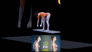 FIX FORWARD HEAD POSTURE amp NECK HUMP  FIX HUNCHBACK workout4d [upl. by Anowahs93]