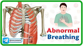 Accessory muscle Breathing Agonal Breathing Apneustic breathing Asterixis and Biots Breathing [upl. by Brod985]