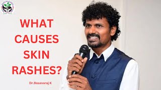 What causes skin rashes [upl. by Castora]