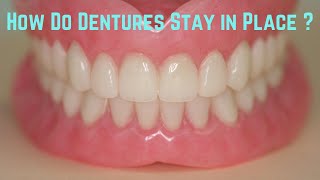 How do dentures stay in place [upl. by Arocal]