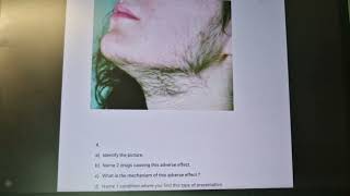 hirsutism pharmacology [upl. by Layman132]