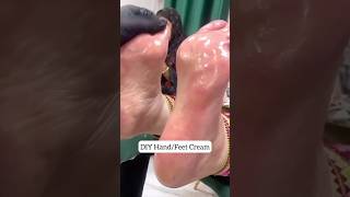 1 Day Repair Cracked Heels Get Fair Hand amp Feet in 1 Day skincare beauty feetwhitening [upl. by Tymothy]