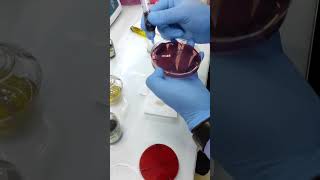 Blood Culture and sensitivity youtbeshorts shorts [upl. by Trebmal]