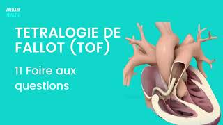 TETRALOGIE DE FALLOT TOF 11 Foire aux questions [upl. by Houghton570]