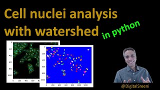 35  Cell Nuclei analysis in Python using watershed segmentation [upl. by Belldas]