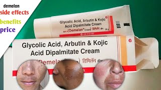 Demelan Cream uses in hindi Pigmentation Cream Demelan cream review चेहरे को गोरा करने के लिए [upl. by Bardo262]