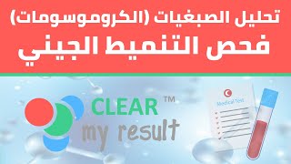 تحليل الصبغيات الكروموسومات  فحص التنميط الجيني Chromosome Analysis Karyotyping Test [upl. by Bridgette]