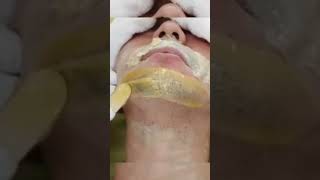 Chin waxing beard hair removal mens waxing shorts shortsvideo [upl. by Elspet]