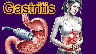 5 Early signs of Gastritis Gastritis diagnosis and treatment [upl. by Canute435]