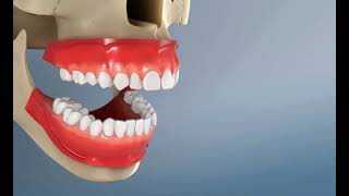 Redresser et aligner ses dents  Les gouttières Orthodontiques ￼invisibles [upl. by Oned]