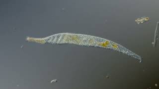 Interstitial Ciliates  Jaffa port [upl. by Nylzor]