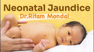 Newborn Jaundice  what to do by DrRitam Mondal MD [upl. by Hallie]