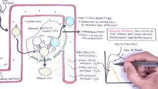 Epstein Barr Virus and Infectious Mononucleosis pathophysiology investigations and treatment [upl. by Yeliah343]