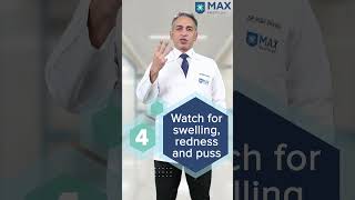 5 tips to treat Skin Ulcers at home  Max Hospital [upl. by Aihseym]