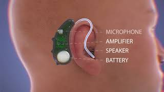 How Do Hearing Aids Work Video [upl. by Haldas13]