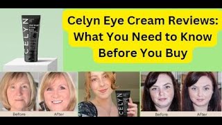 Celyn Eye Cream Reviews what you need to Know [upl. by Pagas738]