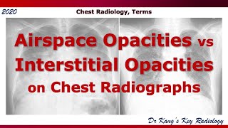 Airspace vs Interstitial Opacities Terms [upl. by Noslien511]