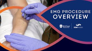 The EMG Procedure Overview of the Nerve Conduction Study Process [upl. by Eyde]