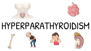 Hyperparathyroidism Primary Secondary and Tertiary  Simple and easy to understand [upl. by Yvette]