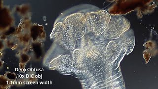 Dero Obtusa  an annelid worm with gills in darkfield and DIC [upl. by Leunas]