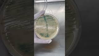 Burkholderia cepacia Trên Môi Trường Thạch UTI  Điều Bạn Cần Biết shorts labinsight [upl. by True702]