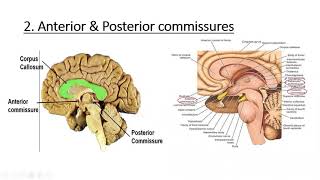 Neuroanatomy Cerebrum White Matter [upl. by Gnemgnok]