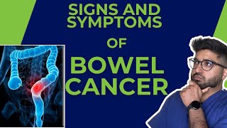 8 Signs and Symptoms of Bowel Cancer You NEED to Know  cancer [upl. by Worden615]